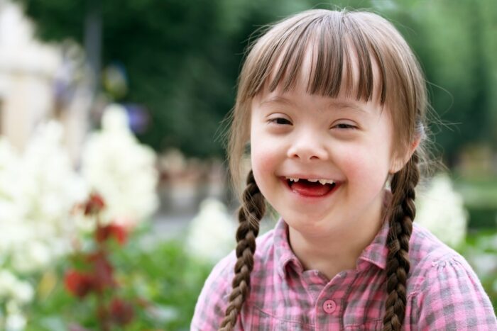 LE CARATTERISTICHE DEL BAMBINO CON SINDROME DI DOWN